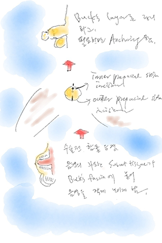 이미지명