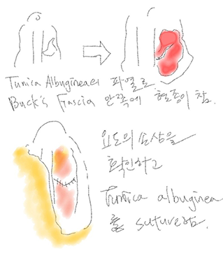 이미지명