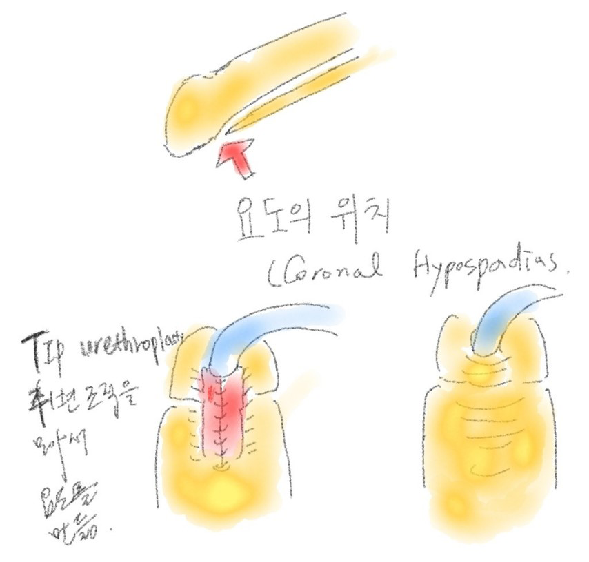 이미지명